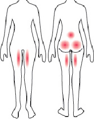 ヒップ・腰・太もも